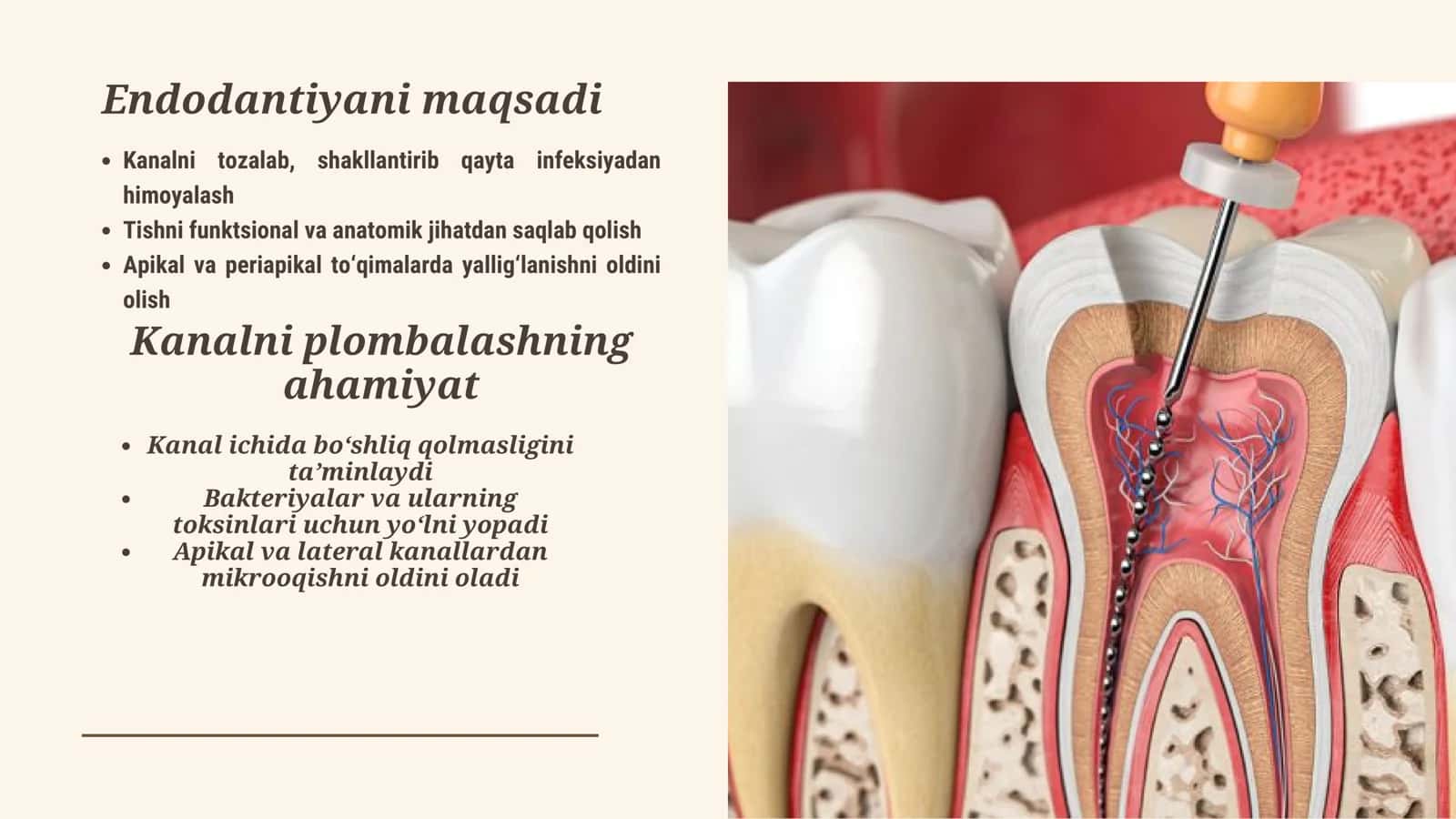 Ildiz kanallarini plombalash usullari 2