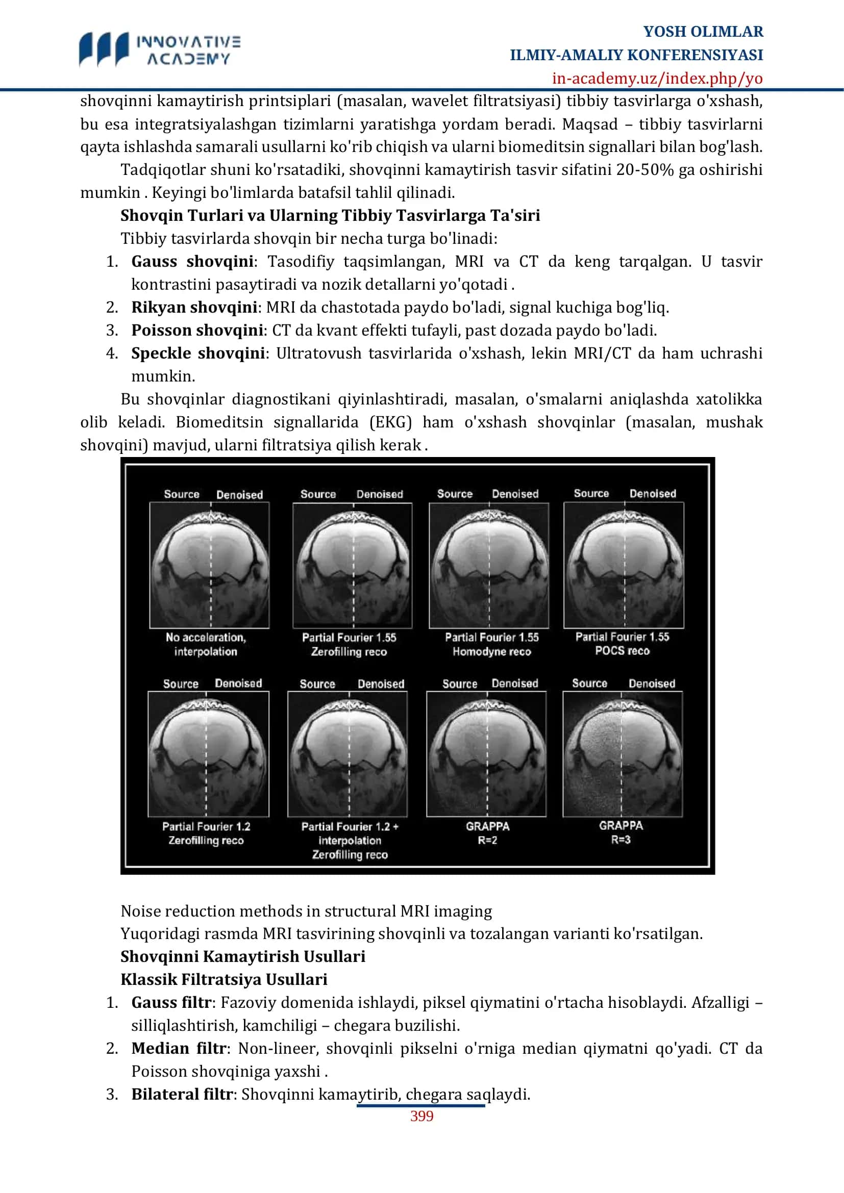 TIBBIY TASVIRLARDA (MRI, CT) SHOVQINNI KAMAYTIRISH VA ENHANCEMENT USULLARI 2