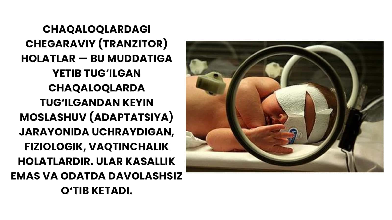 CHAQALOQLARDAGI CHEGARAVIY -TRANZITOR HLATLARI. MUDDATIGA YETAY TUG'ILGAN CHAQALOQ 2
