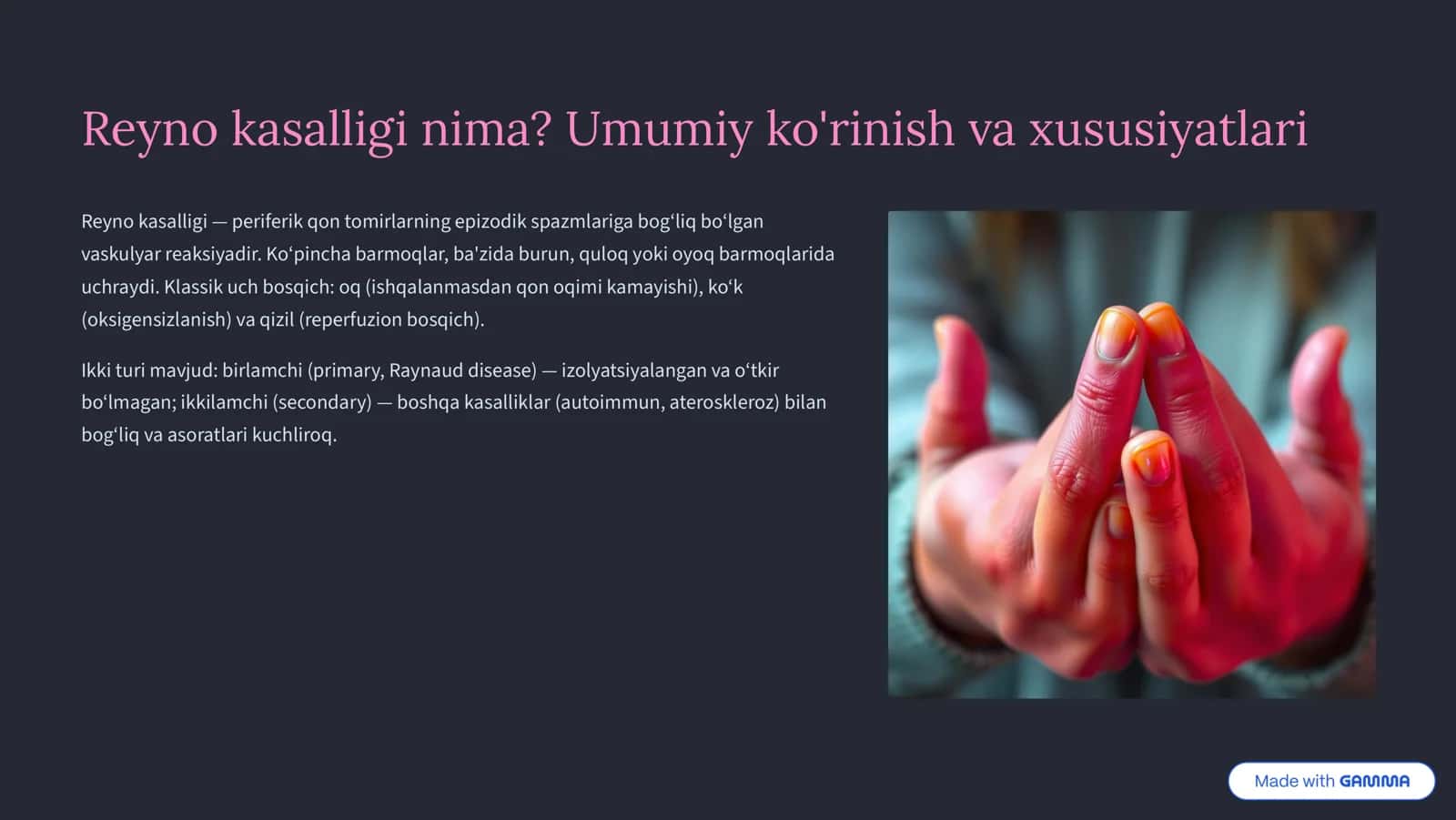 Reyno va Byurger kasalliklari: Tushunish va Boshqarish 2
