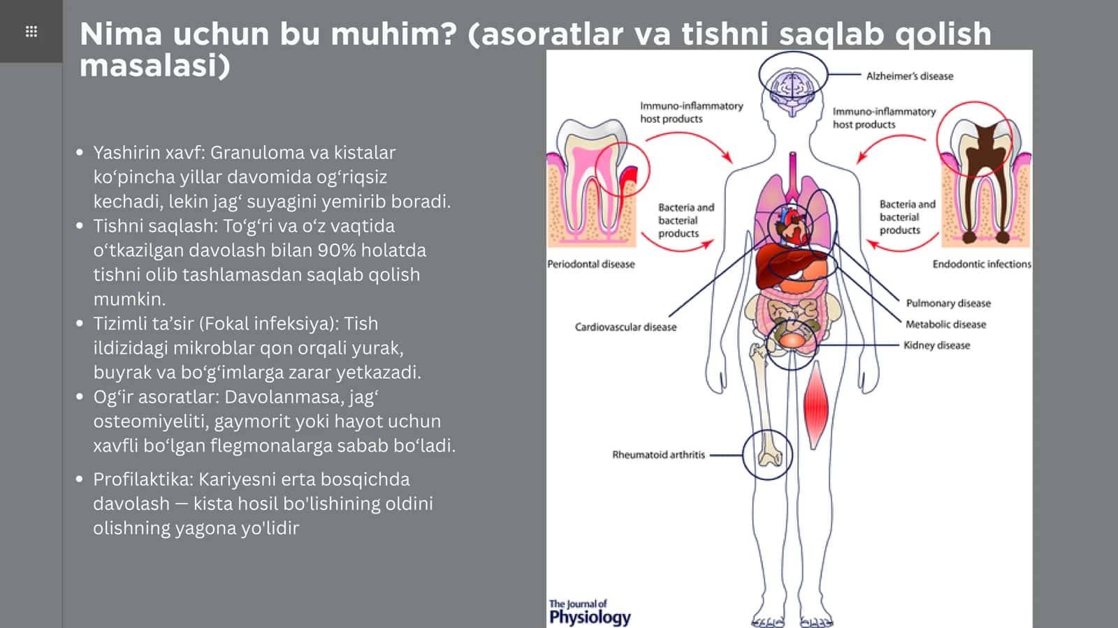 Periapikal granuloma va kistalar: diagnostika va qiyosiy tavsif 2