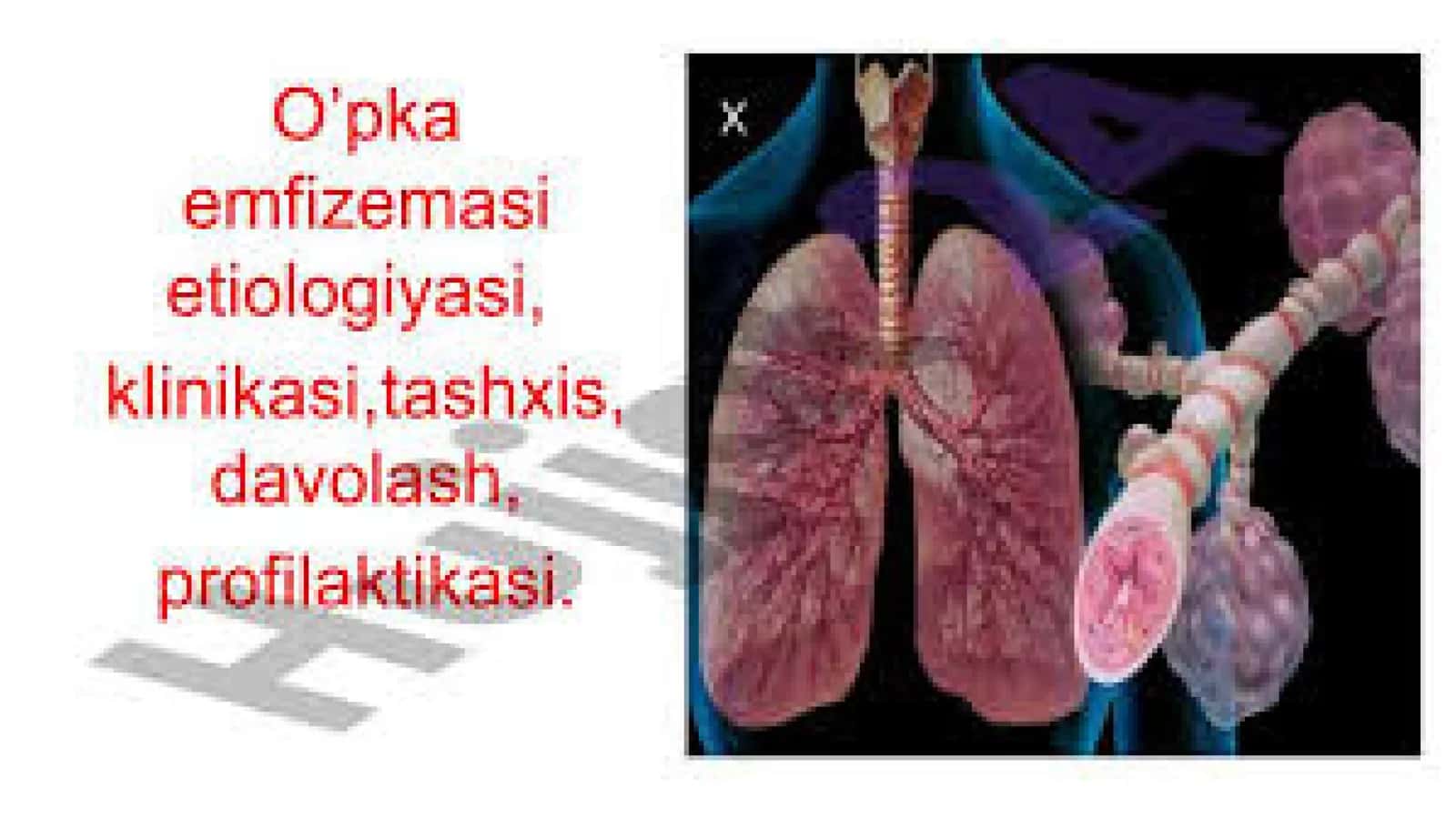 Tibbiyot fakulteti Kilinik fanlar kafedrasi Terapiya fanidan Mustaqil ish 2