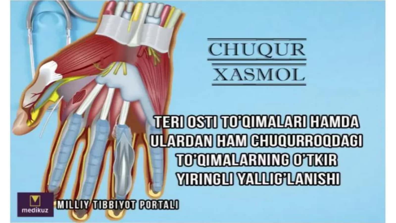 Xasmollar 2