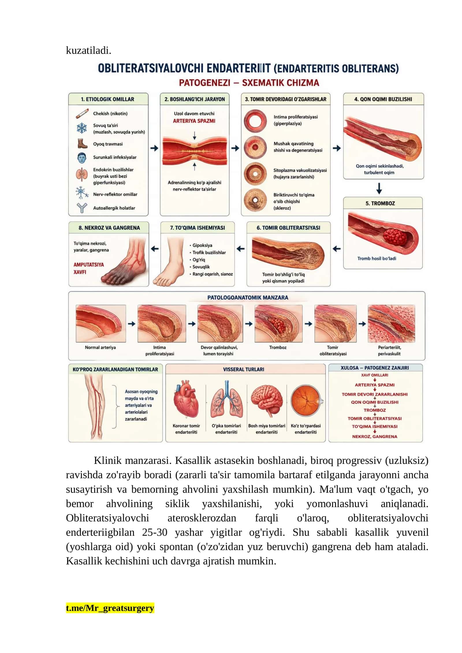 obliteratsiyalovchi qon tomir kasalliklari 2