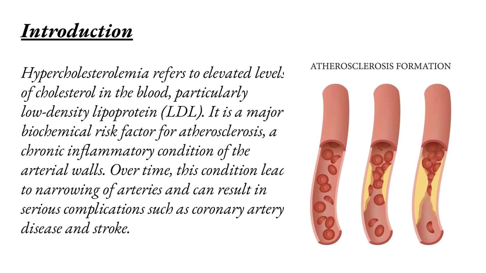 Hypercholesterolemia and Atherosclerosis 2