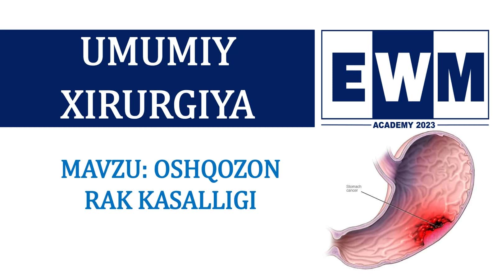 OSHQOZON RAK KASALLIGI 2