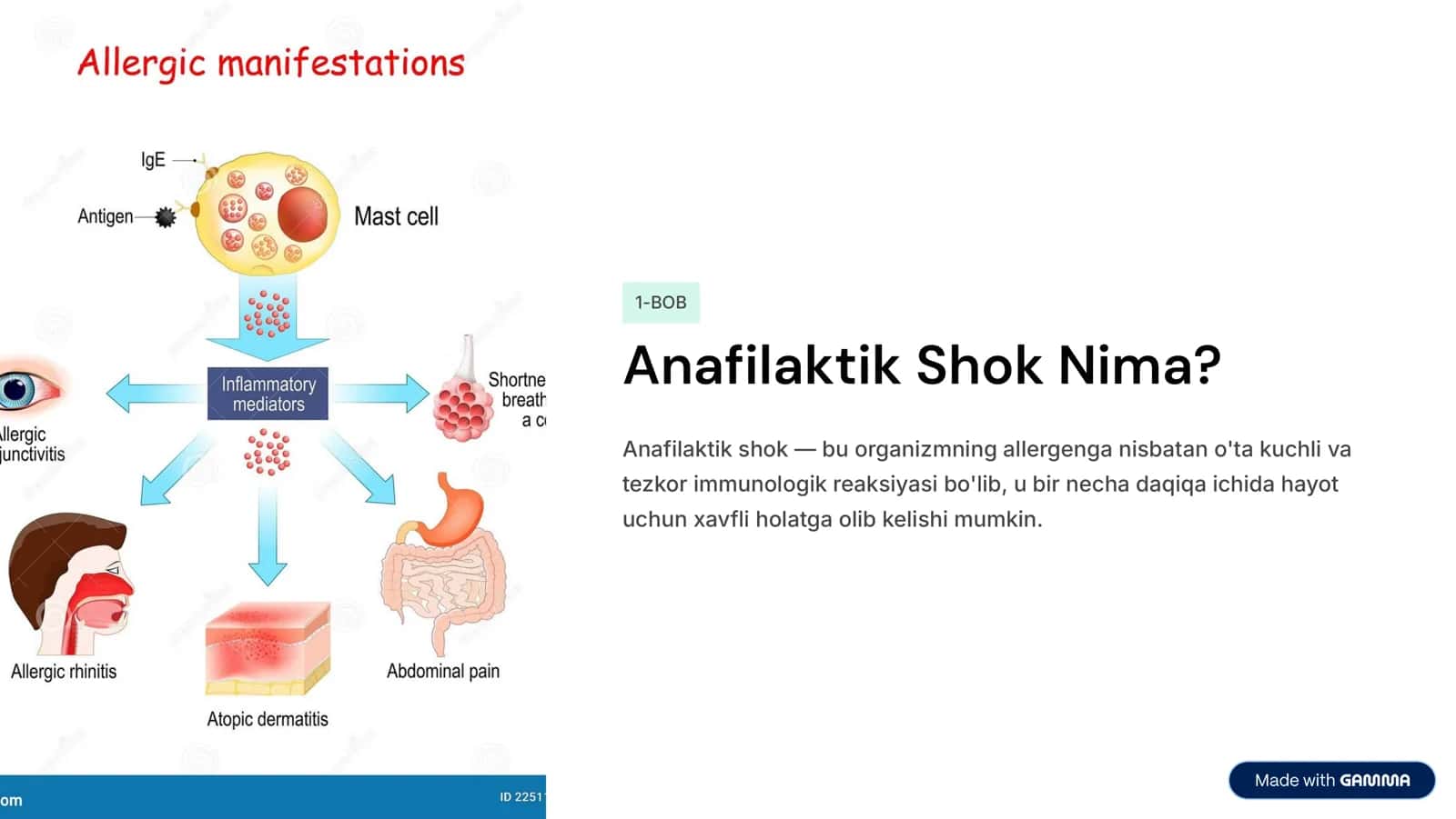 Bemоrdа аnаfilаktik shоk klinik belgilаri. O’pkа yurаk reаnimаtsiyasi. 2