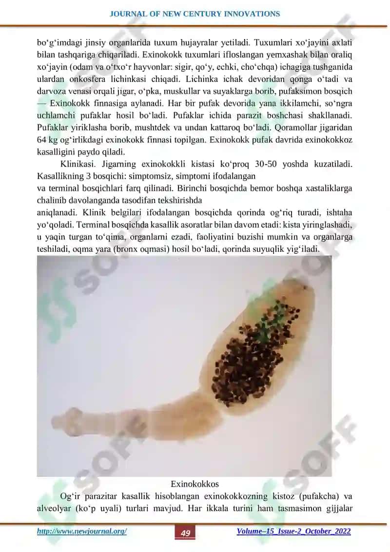 JIGAR EXINOKOKKOZ KASALLIGIDA JARROHLIK ASPEKTLARINI TAKOMILLASHTIRISH 2