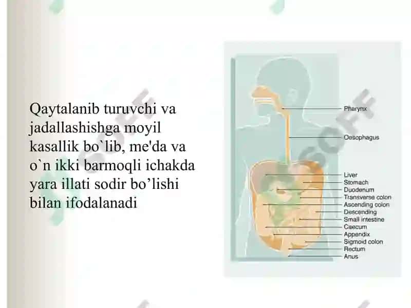 Me'da va 12 barmoqli ichak yara kasalligi 2