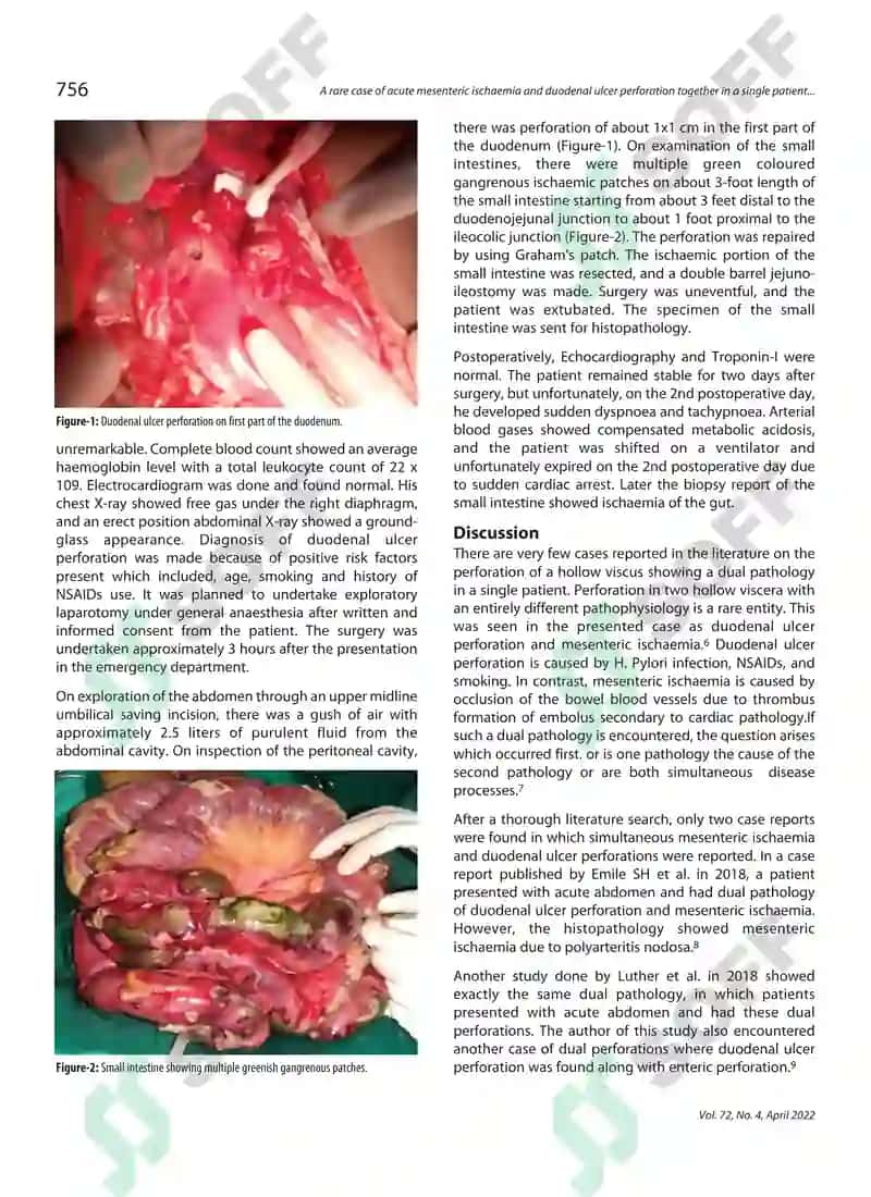 Acute mesenteric ischaemia Report 2
