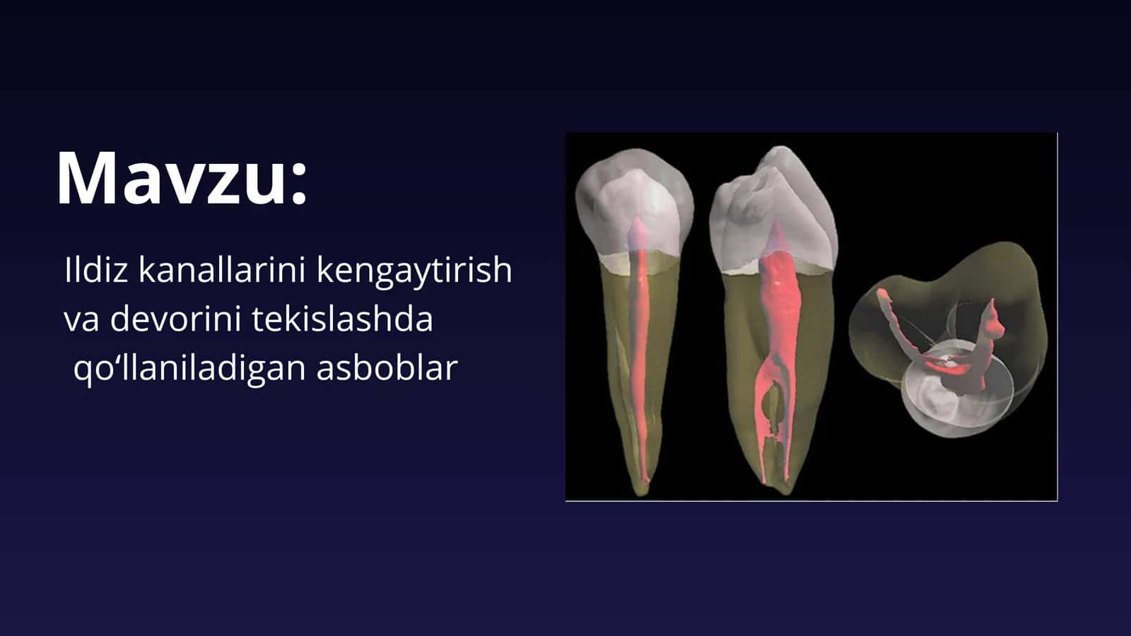 Ildiz kanallarini kengaytirish, devorini tekislashda qoʻllaniladigan asboblar 2