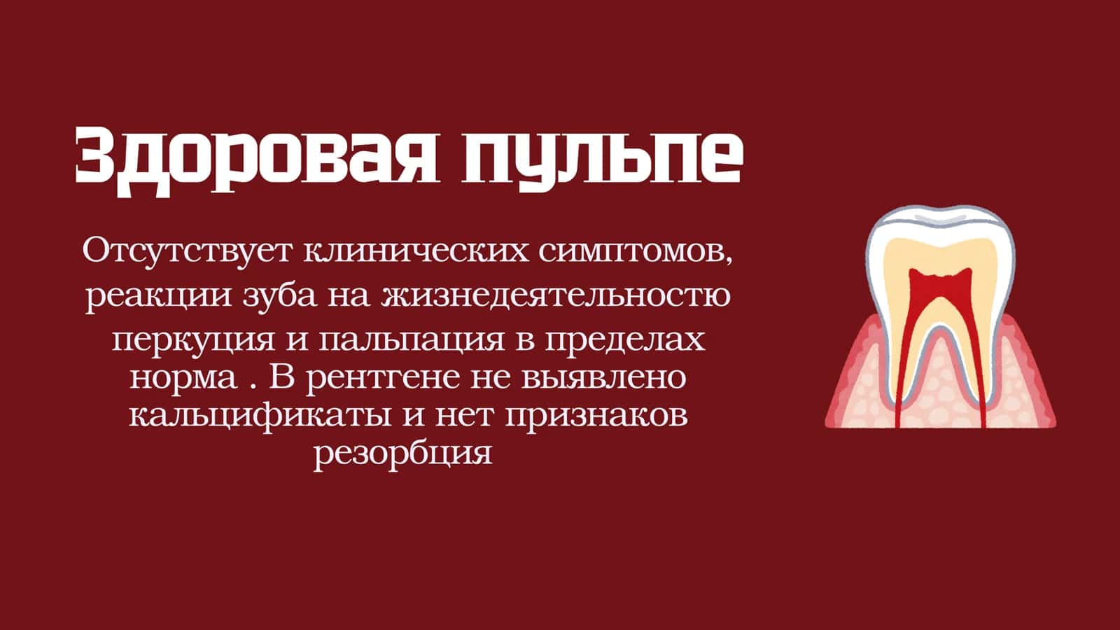 ПАТОЛОГИИ ПУЛЬПЫ 2