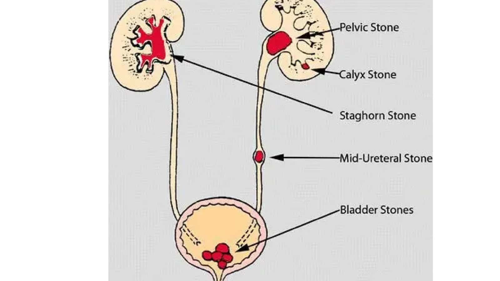 Siydik ayirish azolarining tuzilishi, fiziologiyasi 3