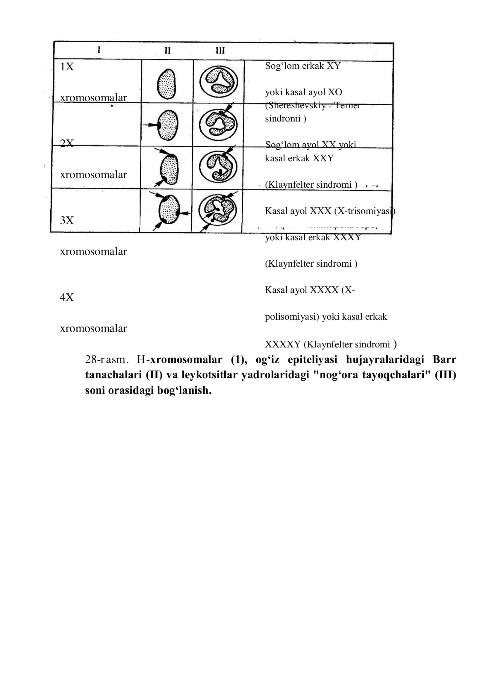 IRSIY KASALLIKLAR. XROMOSOMA KASALLIKLARI 3