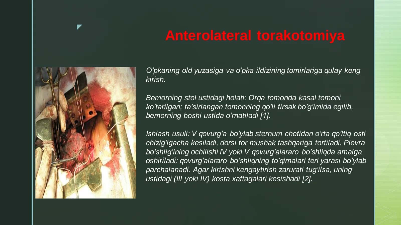 Bolalardagi torakotomiya hususiyatlari 3