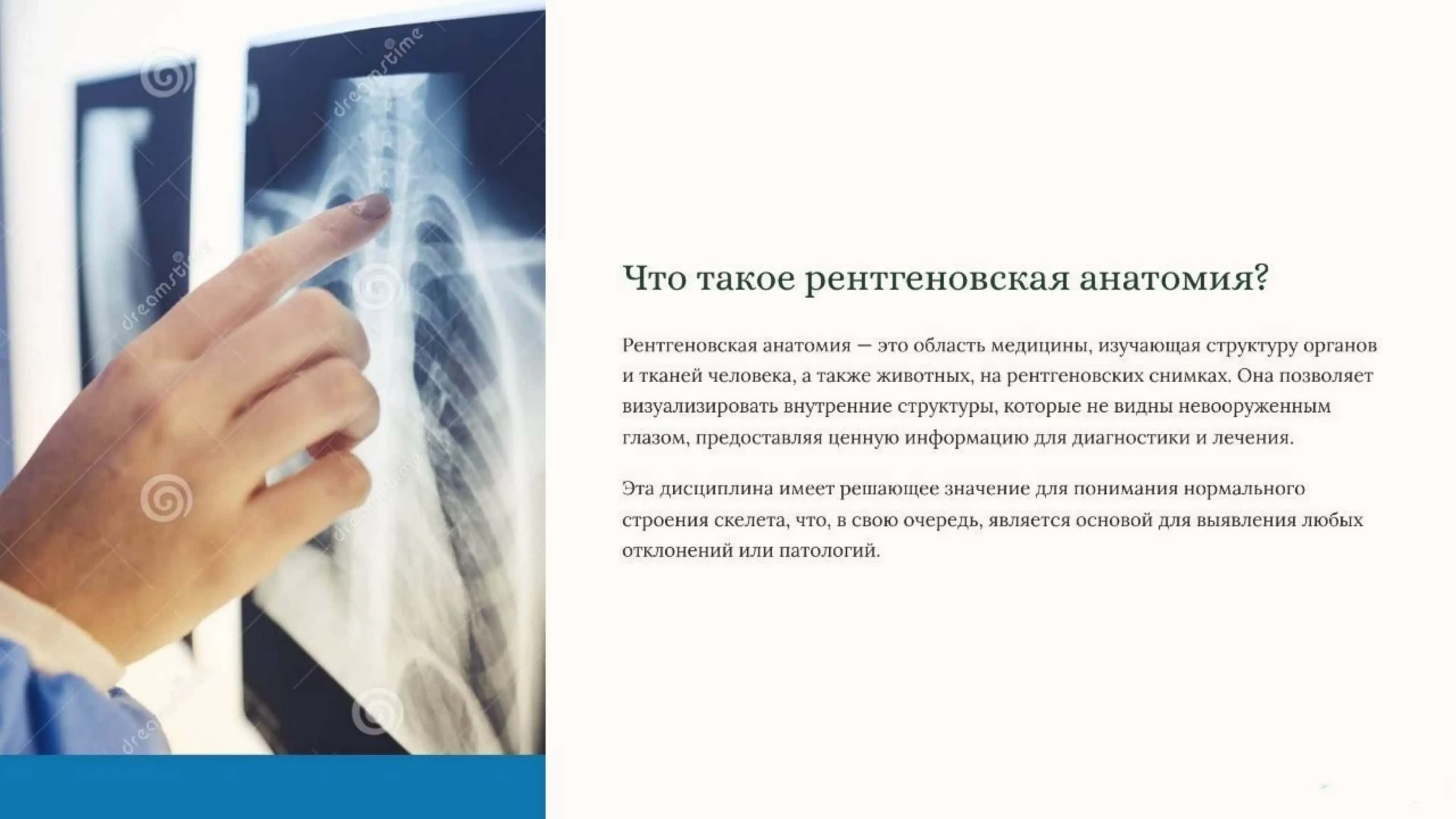 Рентгеновская анатомия костей скелета. Аномалии развития скелета. 3