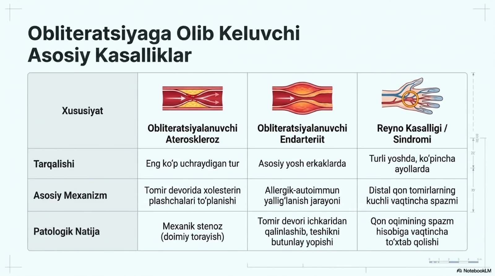 Obliteratsiyalovchi tomir kasalliklari 3