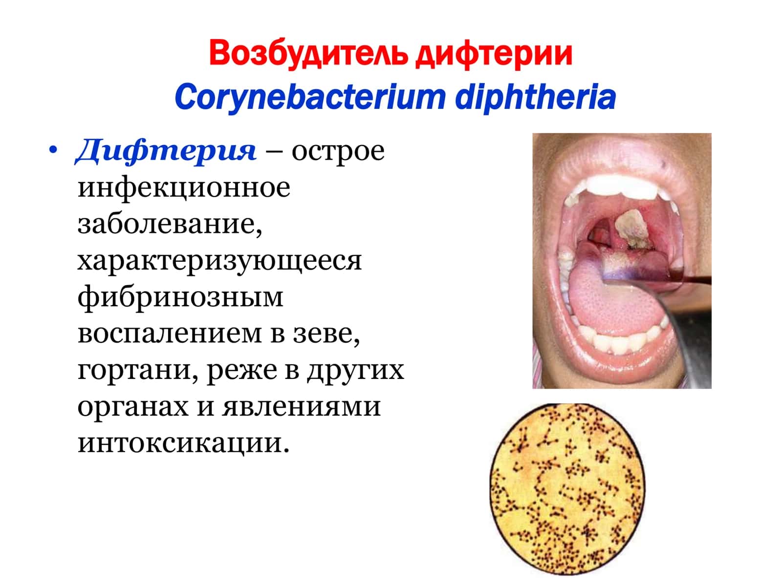 Возбудители токсических инфекций 3