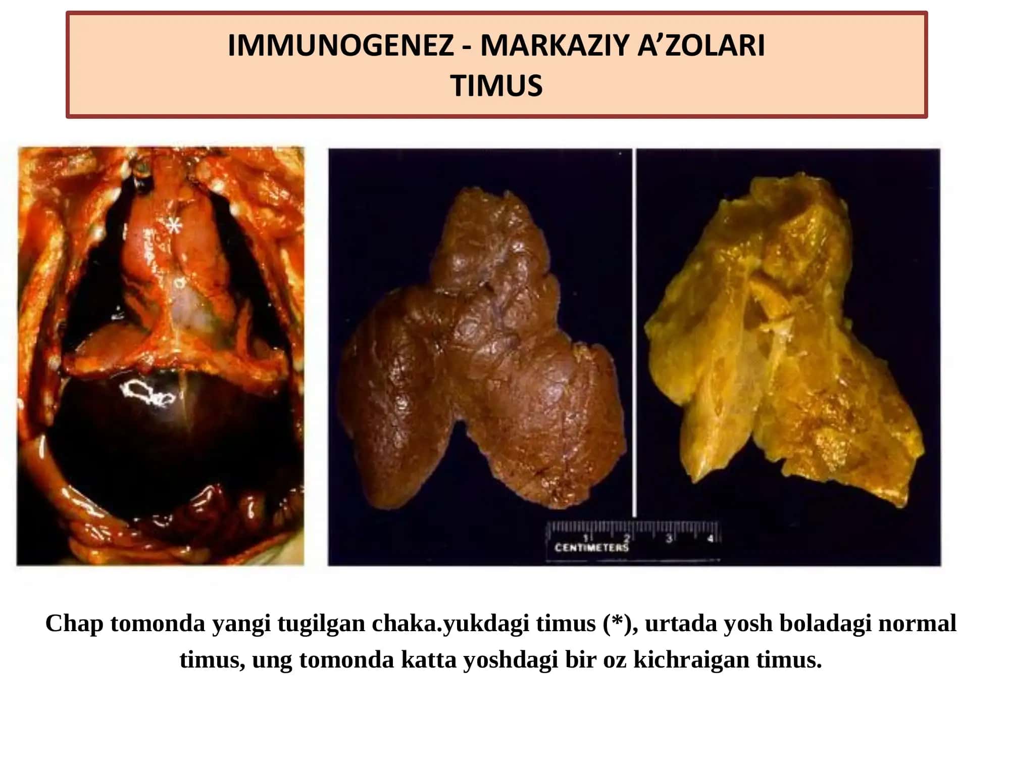 Immunapatologik jarayonlar. O’a sezuvchanlik reaksiyalari. Autoimmun kasalliklar 3