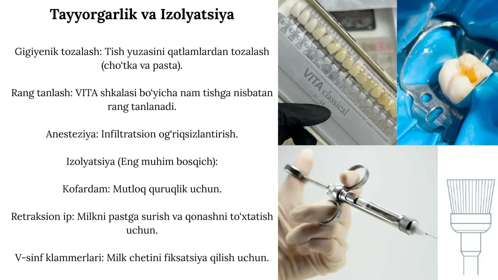 Fantomlarda V sinf karioz bo plombalash va davolash 3