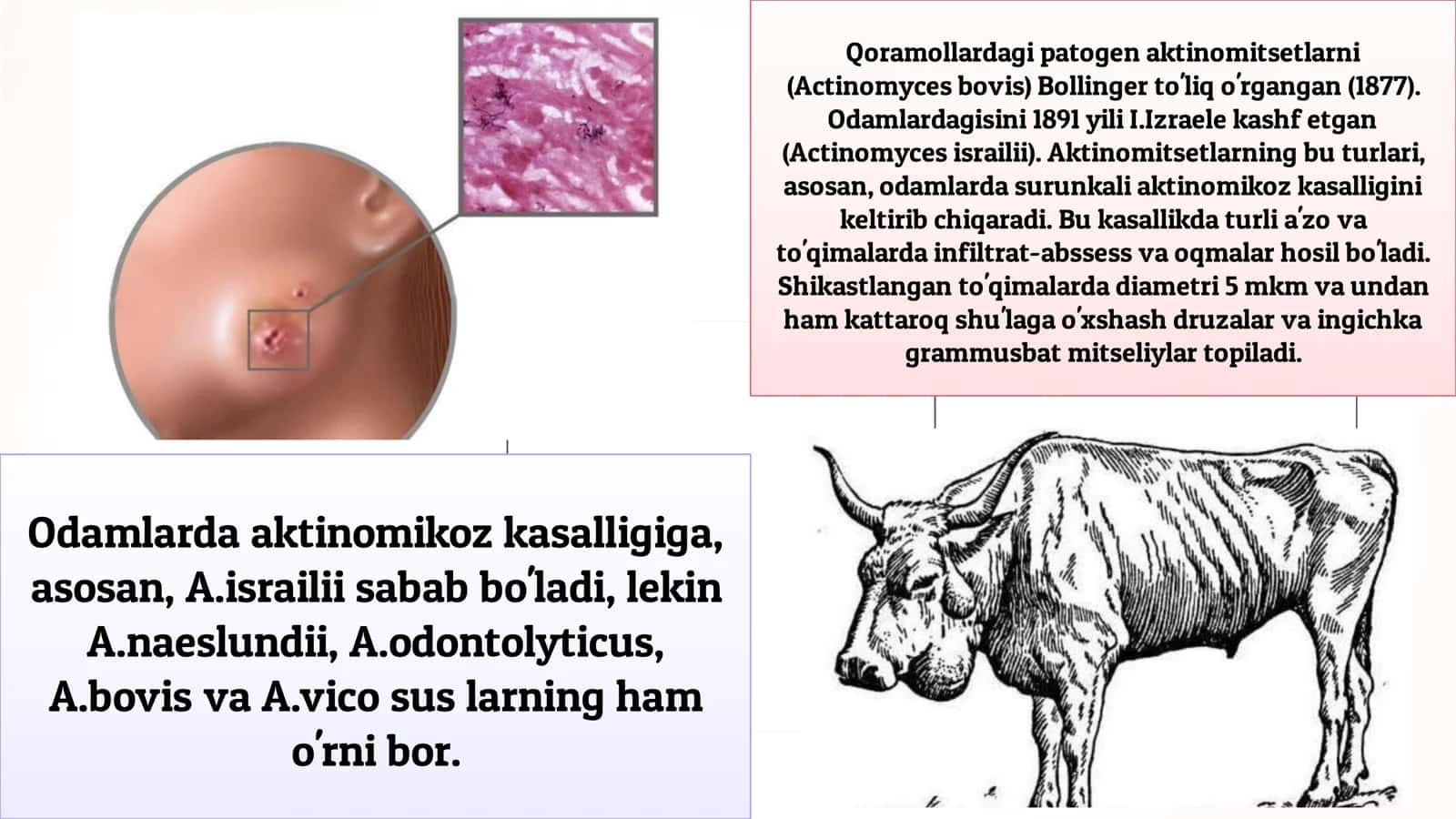 Mikoz kasalliklar: aktinomikozlar. Kasallik labaratoriya diagnostika. 3