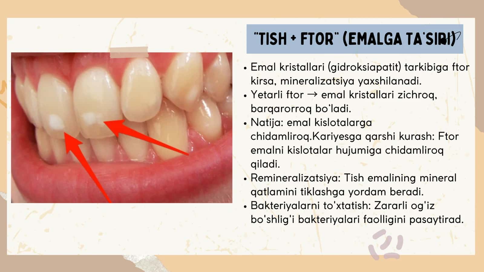 STOMATOLOGIK KASALLIKLAR PROFILAKTIKASIDA FTOR 3
