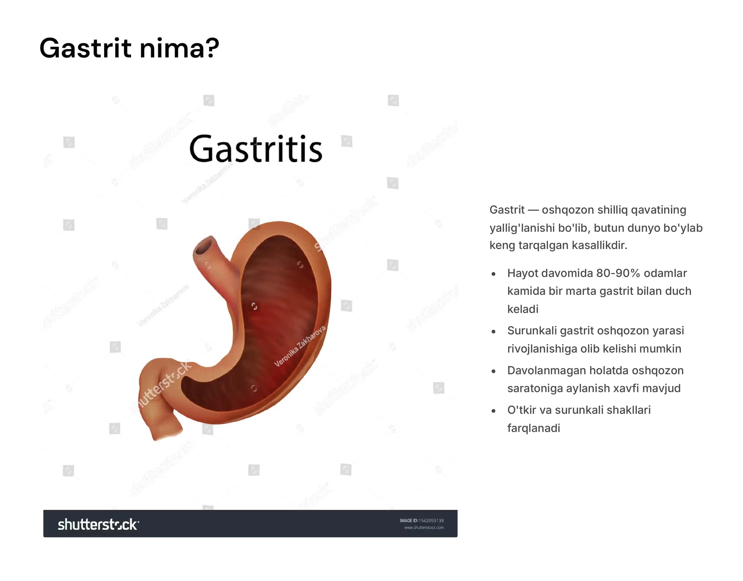 Gastrit, oshqozon-ichak yarasi va kolit kelib chiqishida mikroorganizmlarning ahamiyati, patogenezi, laboratoriya tashxisi. Kampilobakteriyalar, xelikobakteriyalar va ularning amaliyotdagi ahamiyati. 3