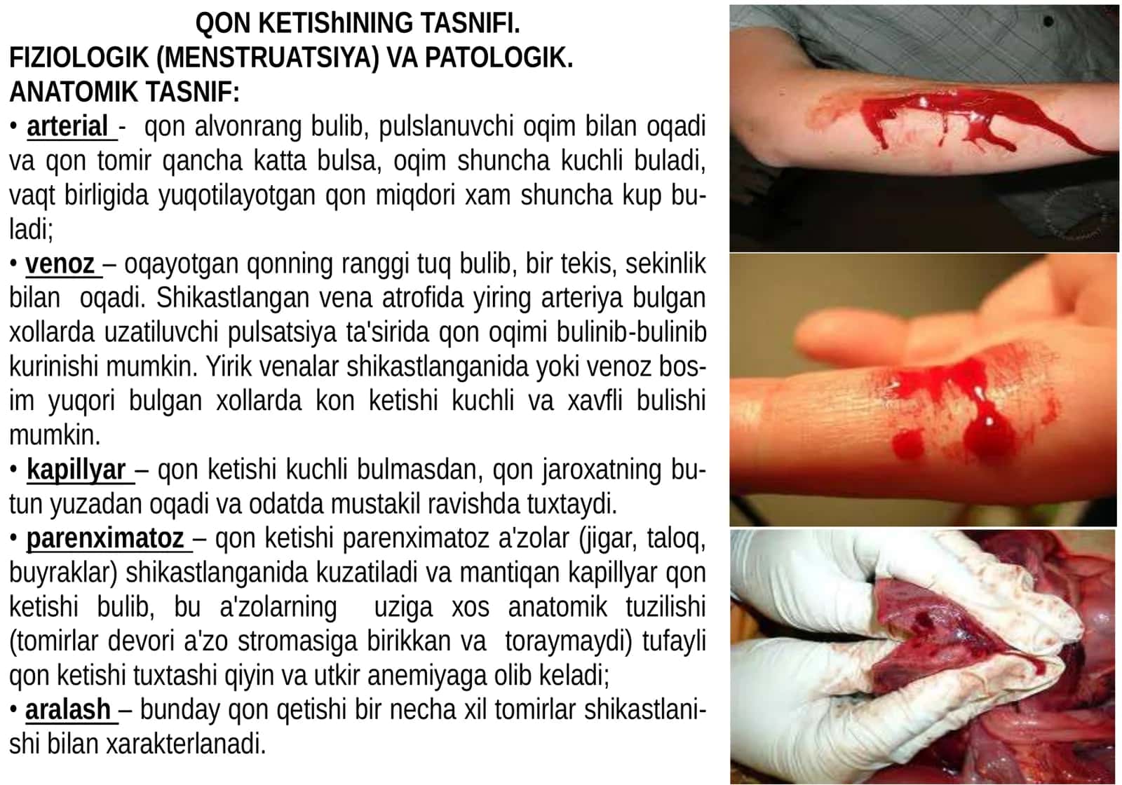 QON KETISHI VA UNI TUXTATISH. TRANFUZIOLOGIYA ASOSLARI 3