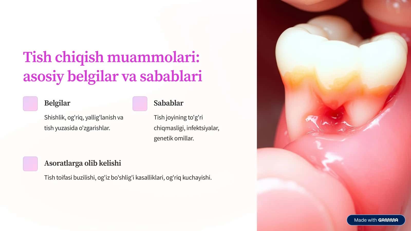 Tish chiqish kasalliklarini zamonaviy rentgenologik tekshirish usullari 3