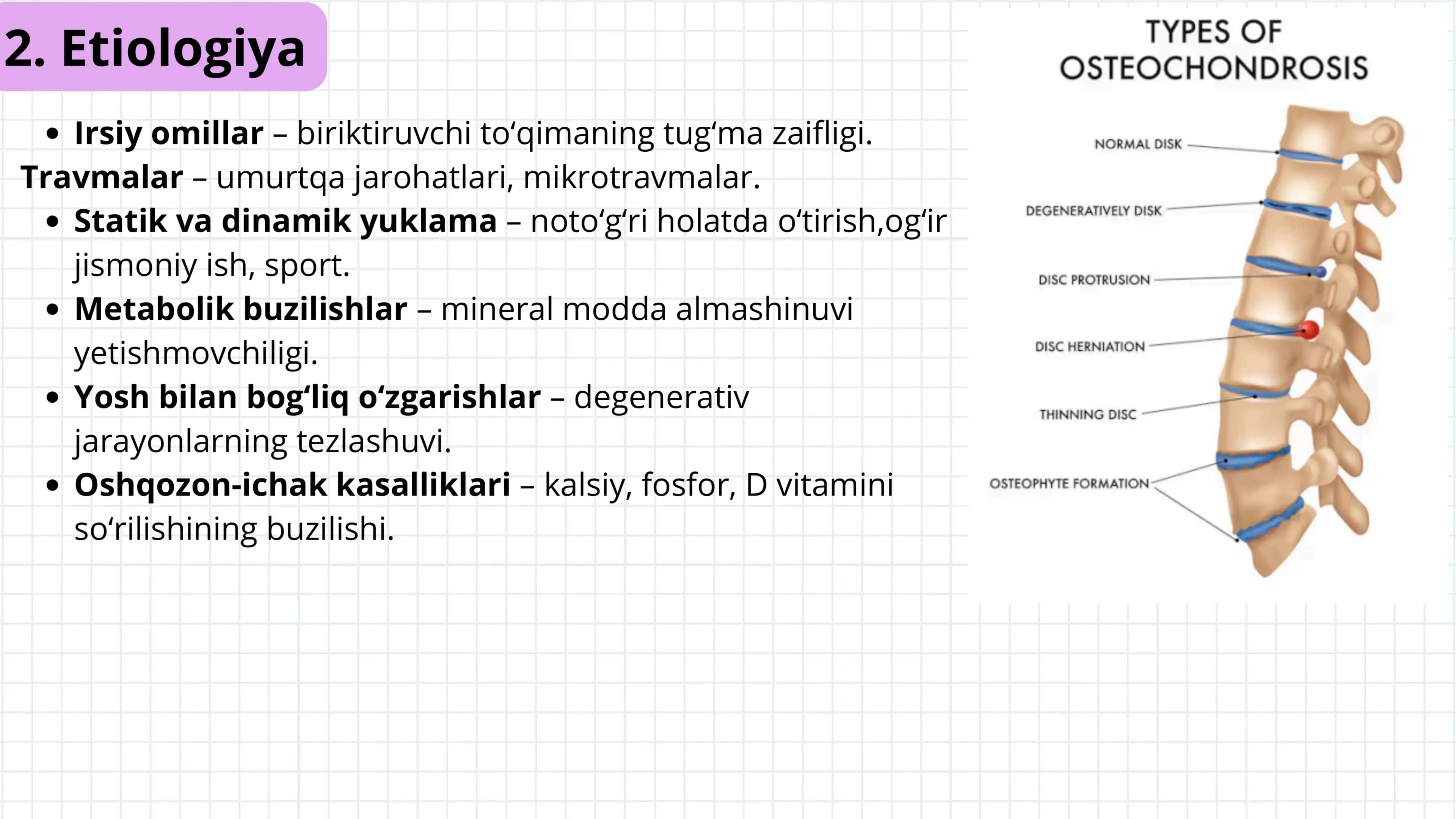 Ostexondroz 3