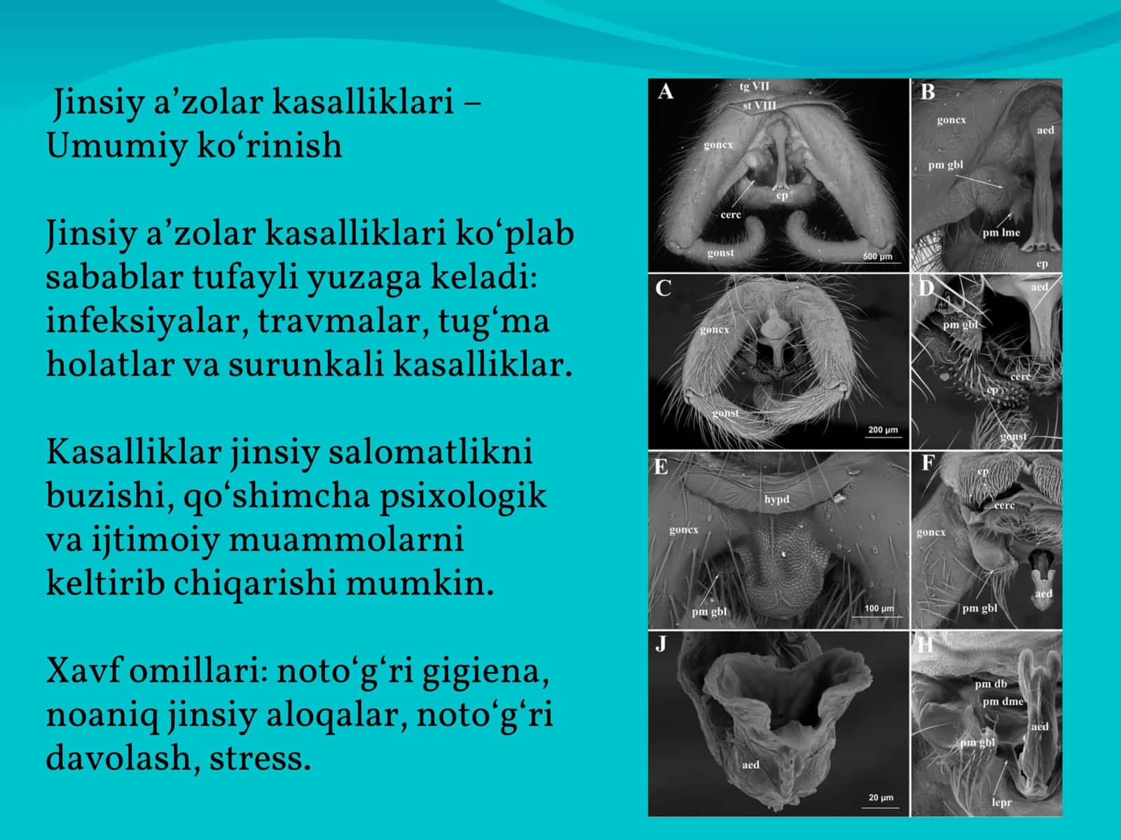 Erkaklar jinsiy a’zolari va uretra kasalliklari 3