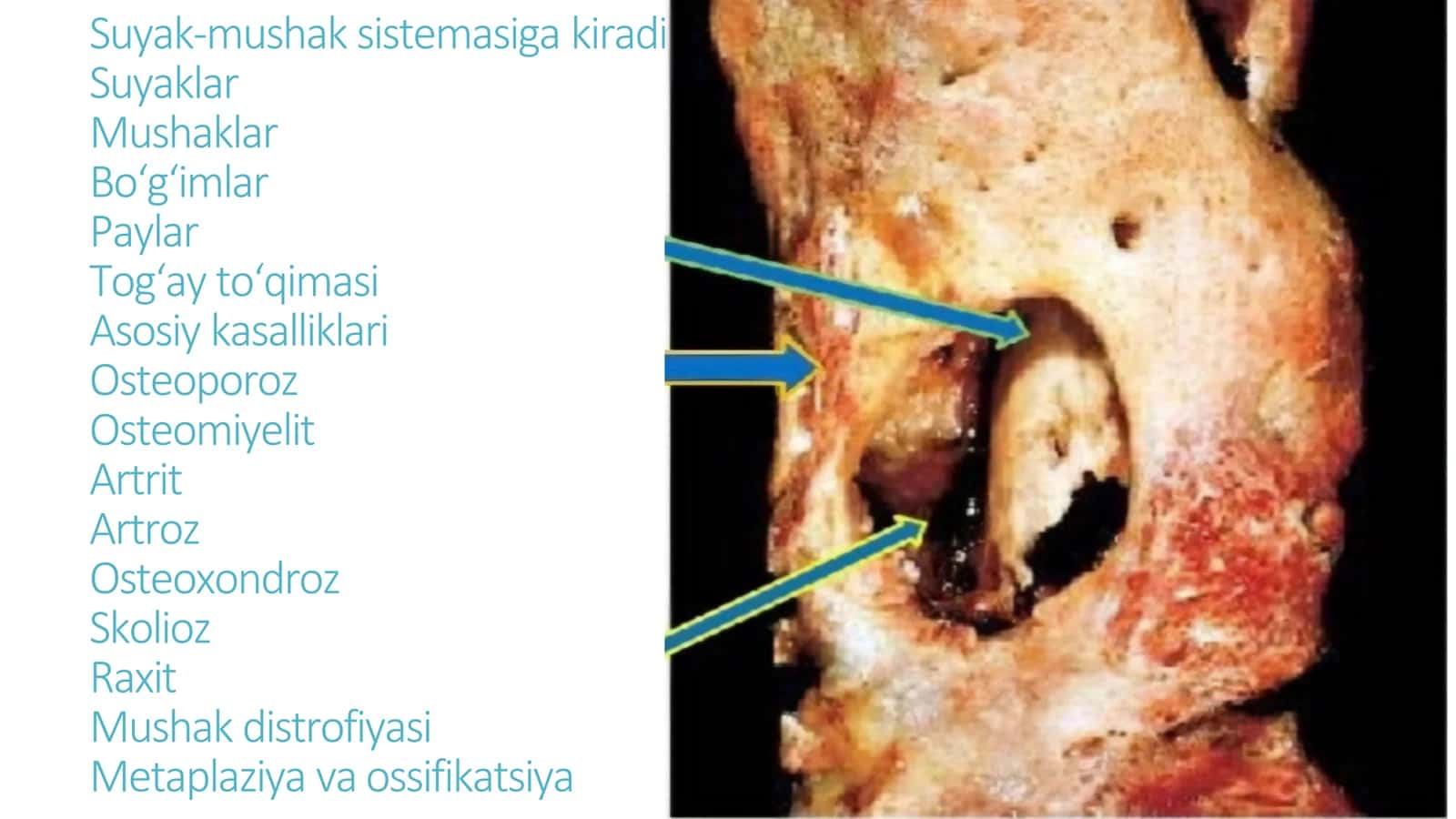Suyak mushak sistemalari 3