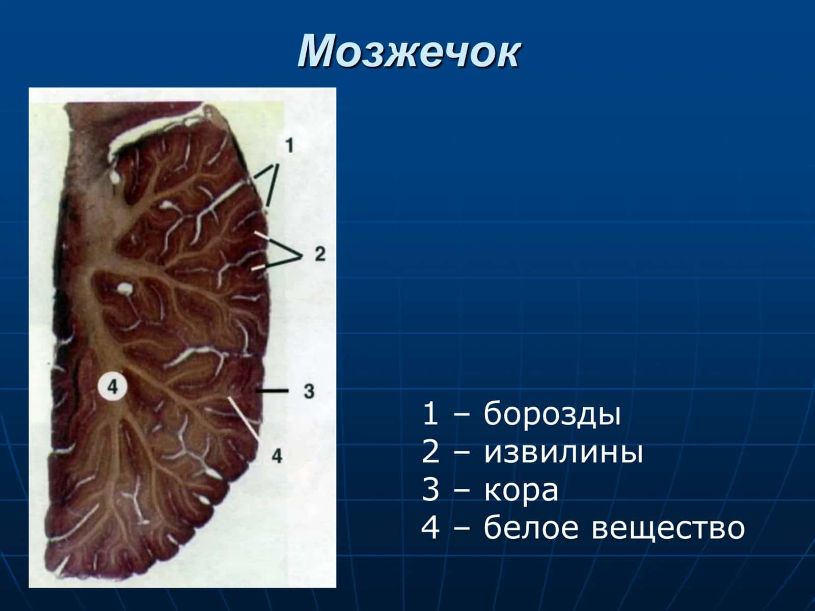 Головной мозг 3