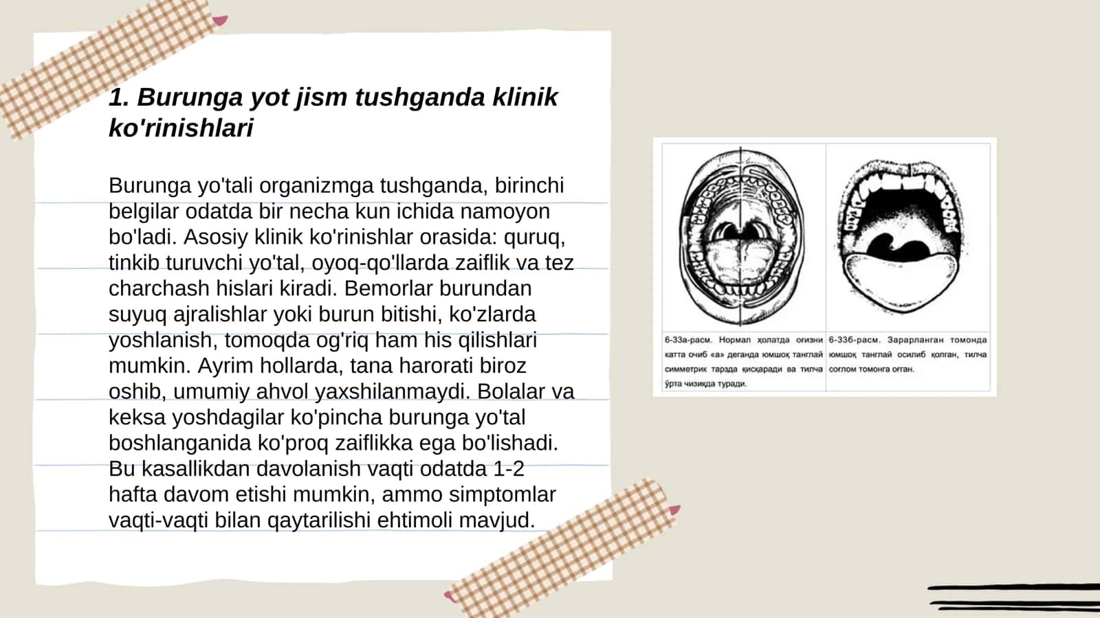 Burunga yot jism tushganda klinikasi, etiologiyasi, Differensial tashxis, va davolash 3