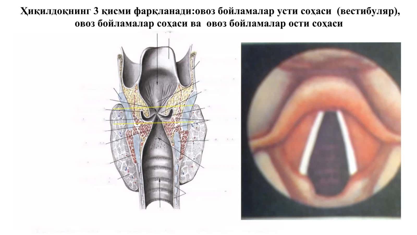 ҲИҚИЛДОҚ РАКИ -С32 3