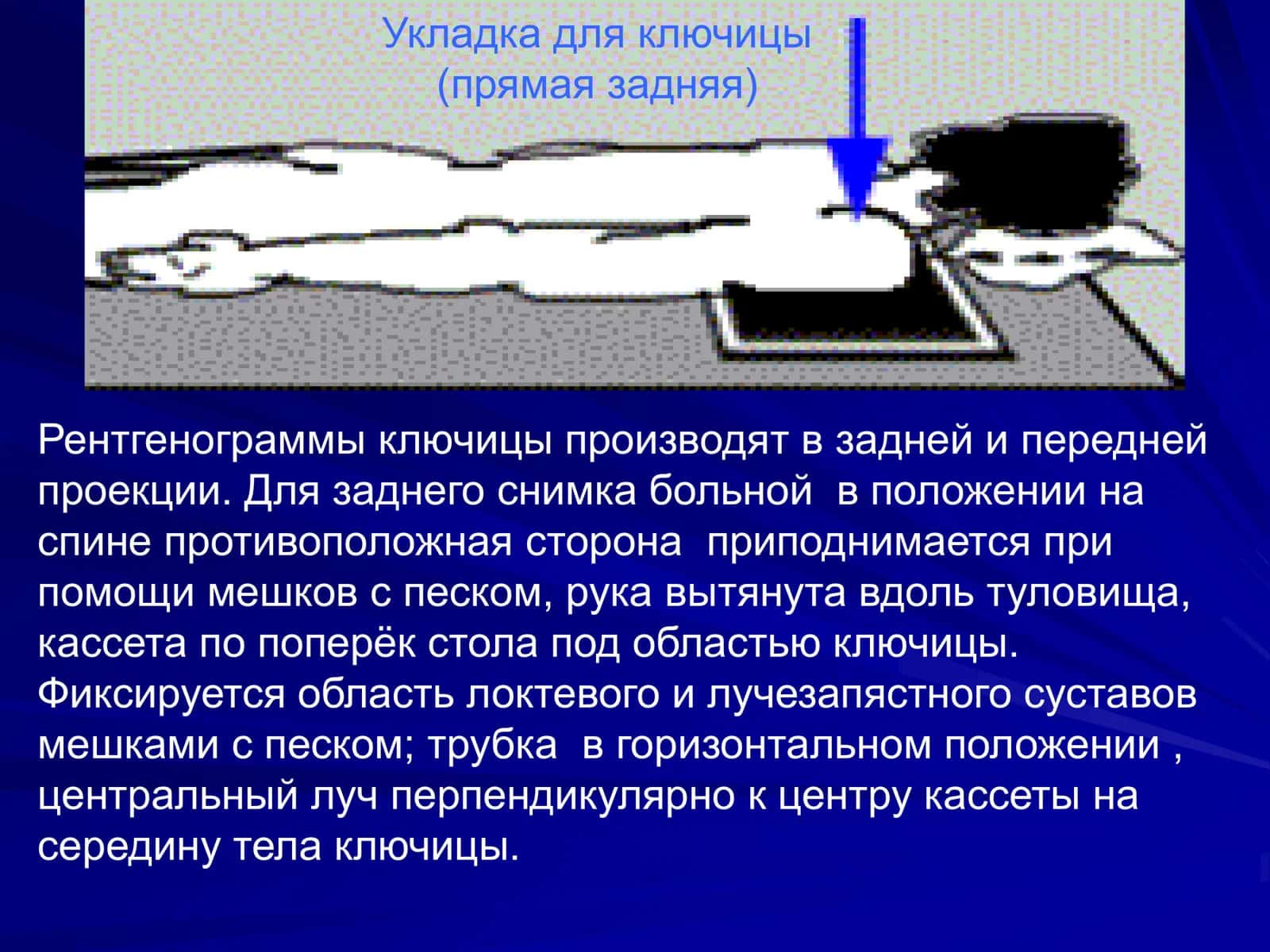 Рентгеноанатомия костно-суставного Аппарата 3