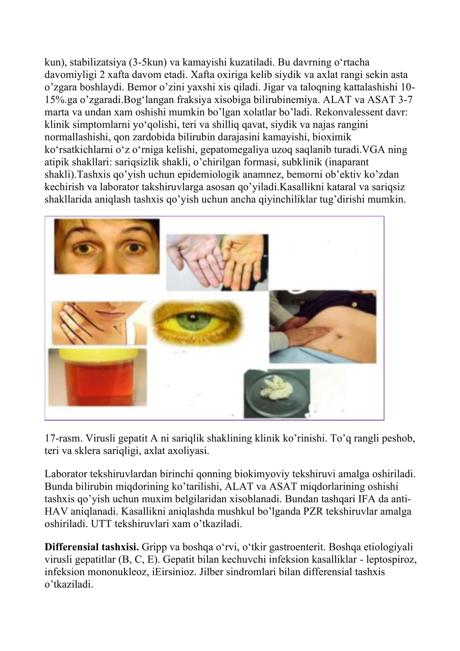 VIRUSLI GEPATIT A VA E (ENTERAL VIRUSLI GEPATITLAR) 3