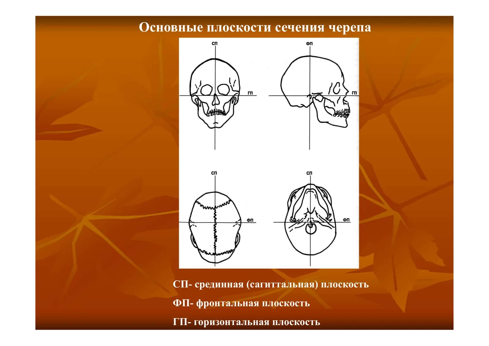 Лучевая диагностика заболеваний черепа 3