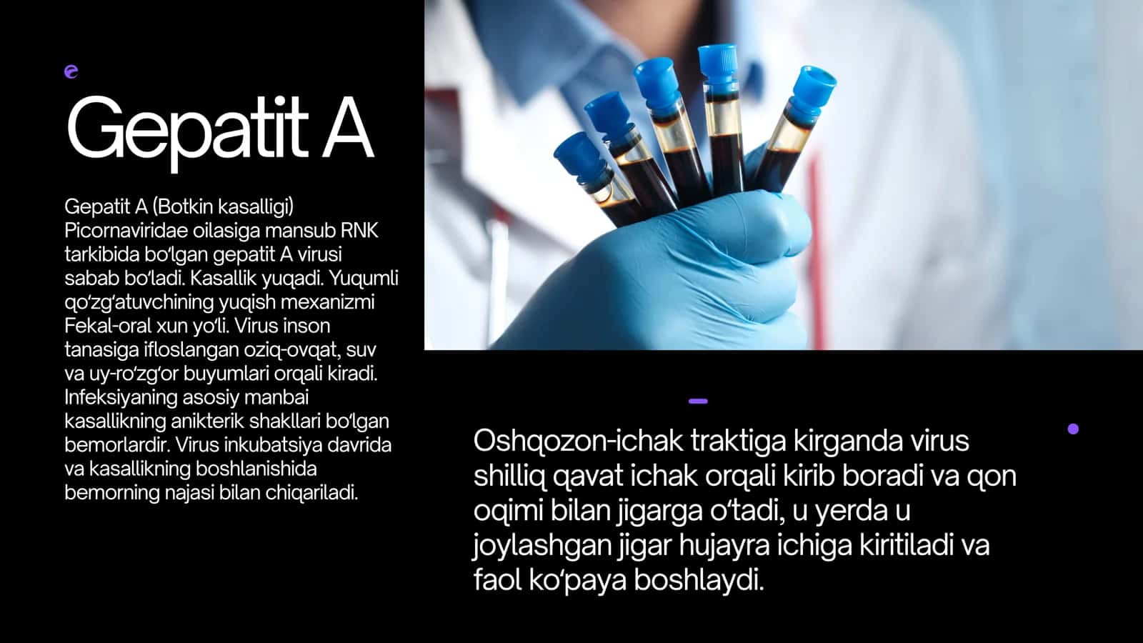 Gepatit A (Botkin kasalligi) 3
