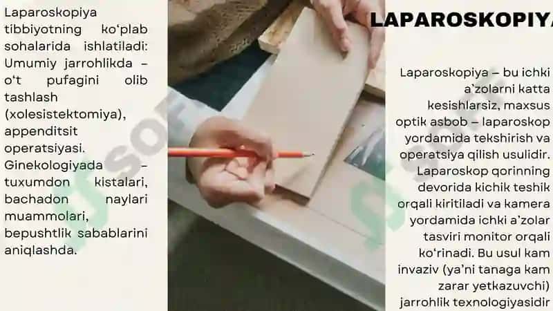Laparoskopiya 4