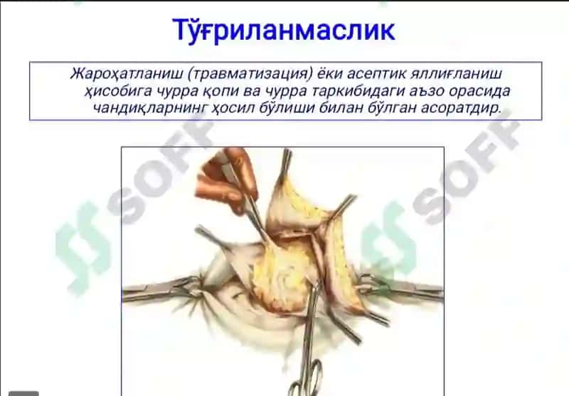 Xirurgiya churralar 4
