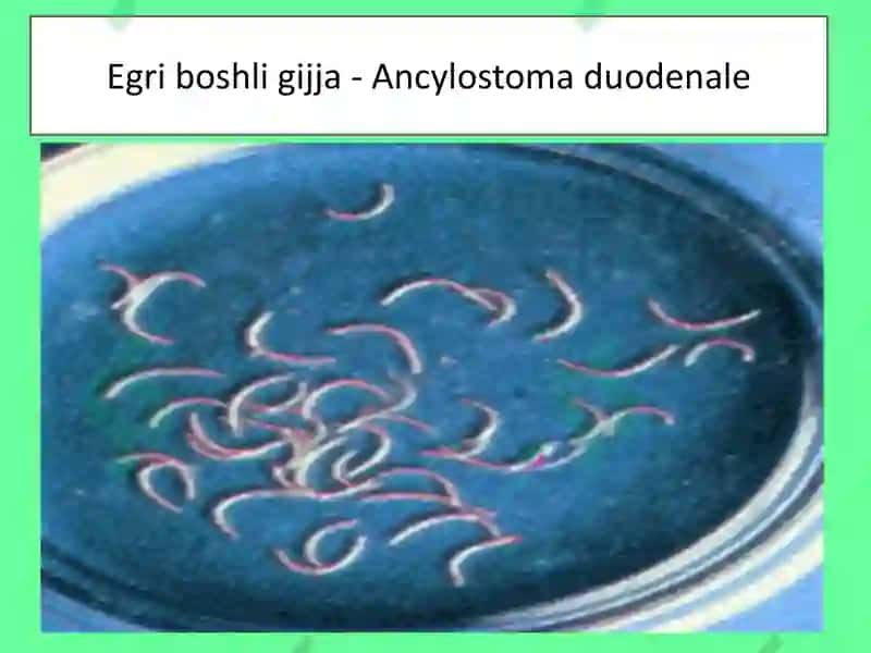 YUMALOQ CHUVALCHANGLAR-ODAM PARAZITLARI EGRI BOSHLI GIJJA, TRIXINELLA, RISHTA 4