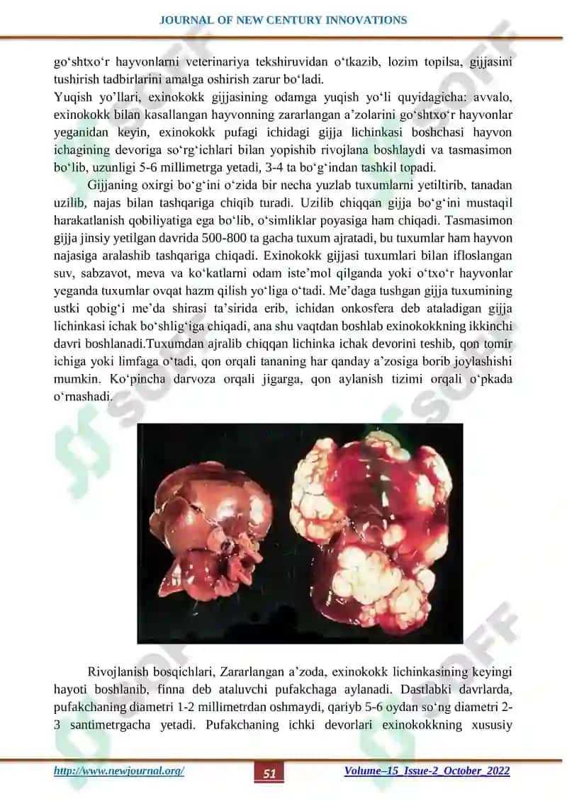 JIGAR EXINOKOKKOZ KASALLIGIDA JARROHLIK ASPEKTLARINI TAKOMILLASHTIRISH 4