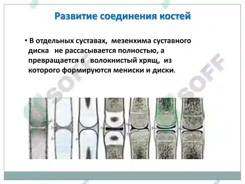 Артрология 7