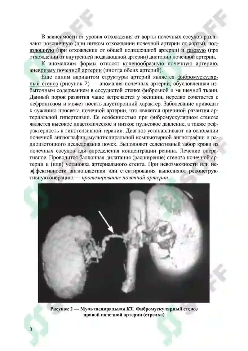 Аномалии мочеполовых органов 8