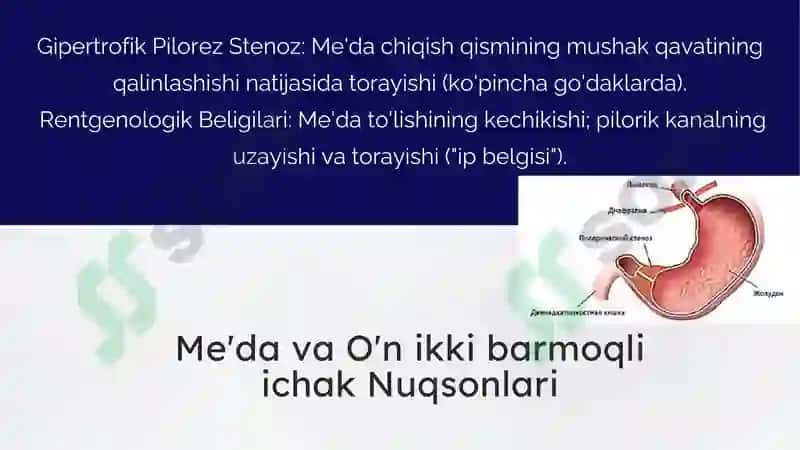Hazm a’zolarini rentgenologik tekshirish 8