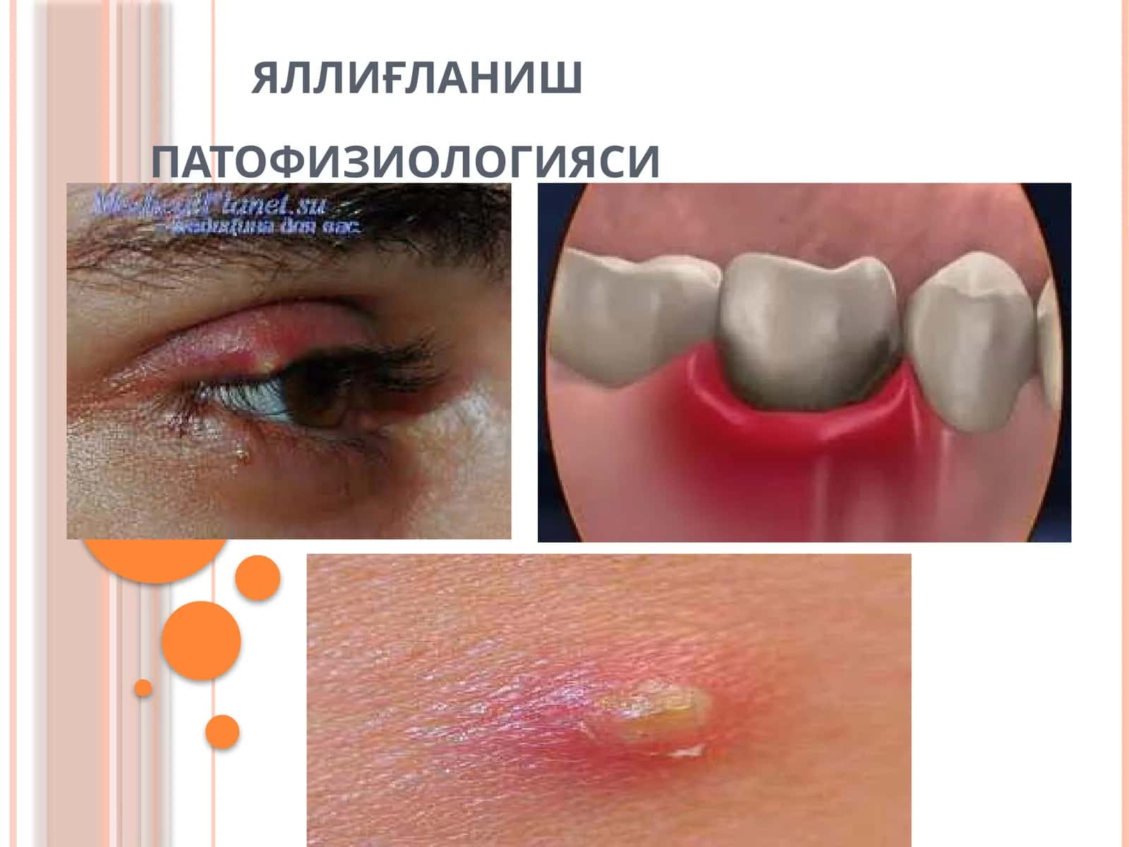 ЯЛЛИҒЛАНИШПАТОФИЗИОЛОГИЯСИ 1