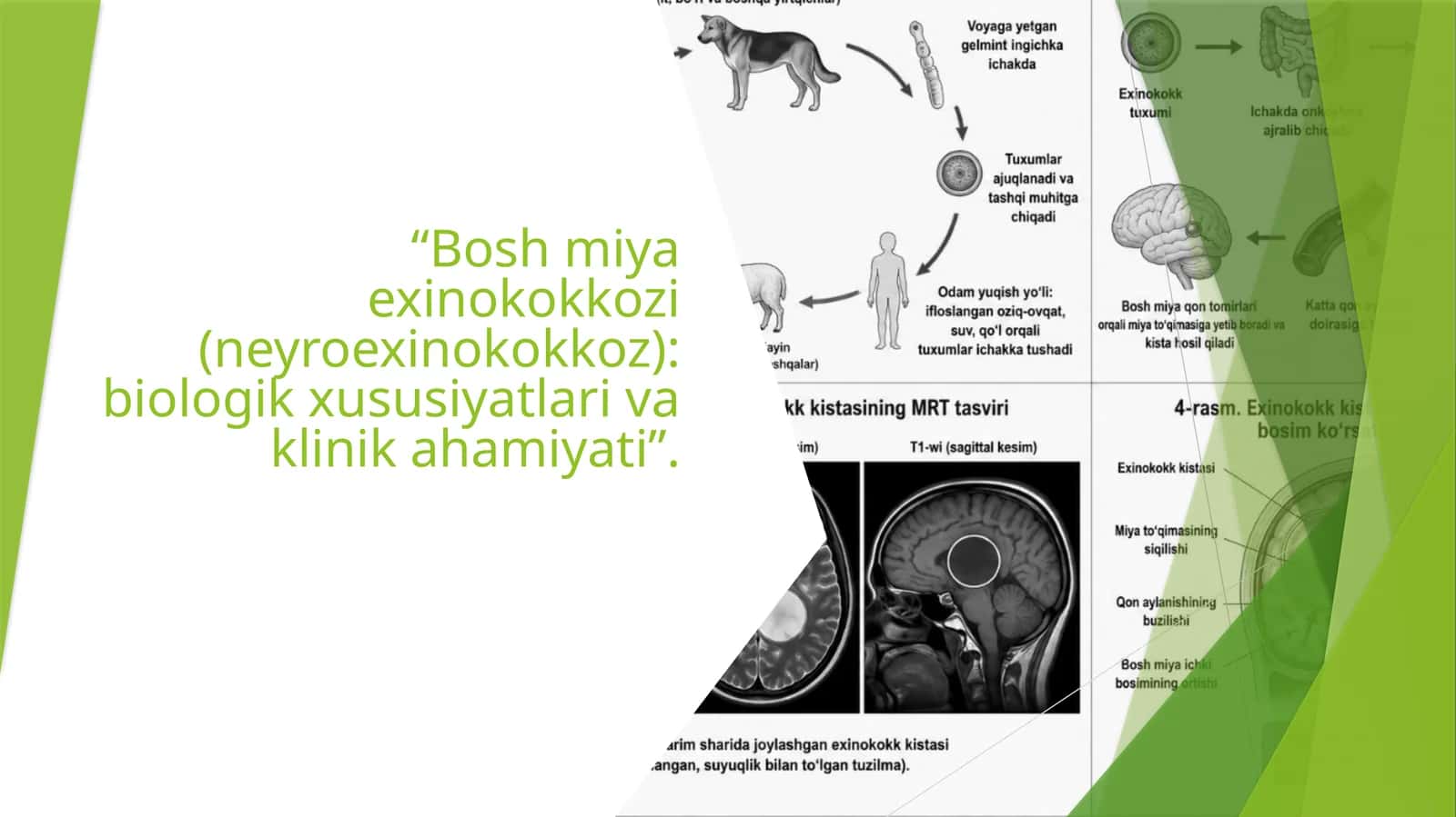 Bosh miya exinokokkozi (neyroexinokokkoz) biologik xususiyatlari va klinik ahamiyati” 1