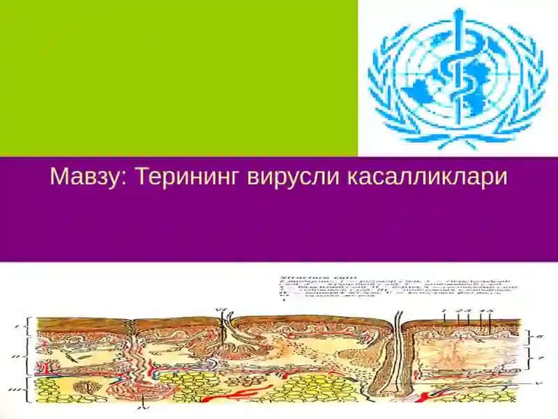 Терининг вирусли касалликлари