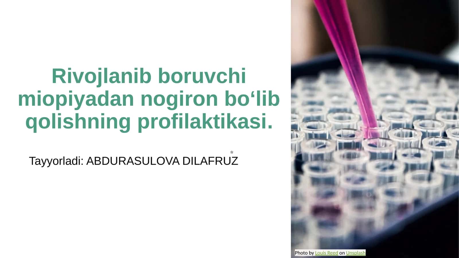 Rivojlanib boruvchi miopiyadan nogiron bo‘lib qolishning profilaktikasi 1